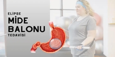 Allurion Mide Balonu